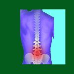 Spondylolisthesis Facts - Spondylolisthesis